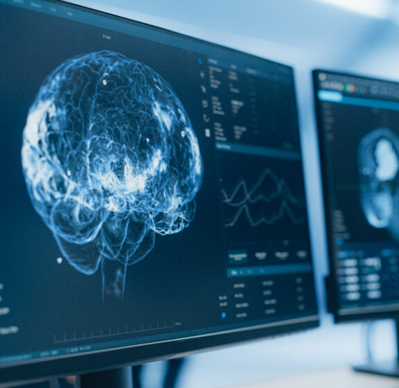 Inside the Reading Brain