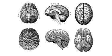 We’ve Known Since the 1980s: The Anatomy of the Dyslexic Brain 🧠