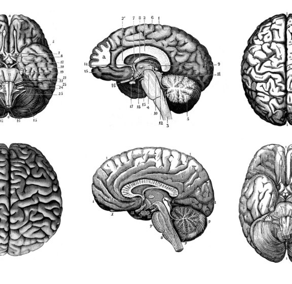 We’ve Known Since the 1980s: The Anatomy of the Dyslexic Brain 🧠